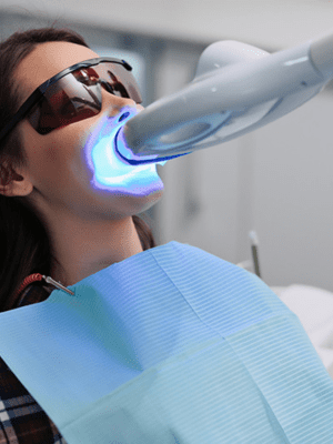 Blanqueamiento dental con Philips Zoom